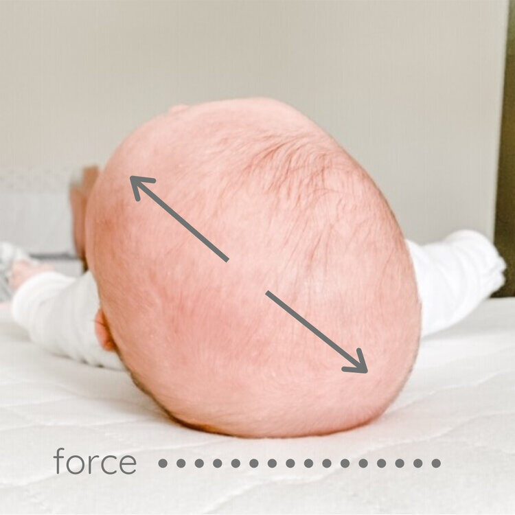 Force+Picture+plagiocephaly